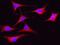 Polo Like Kinase 4 antibody, GTX02303, GeneTex, Immunofluorescence image 