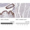 Snail Family Transcriptional Repressor 1 antibody, AMAb91215, Atlas Antibodies, Immunohistochemistry frozen image 