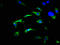 Fibroblast Growth Factor Receptor Substrate 3 antibody, LS-C395700, Lifespan Biosciences, Immunofluorescence image 