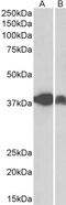 Terminal Nucleotidyltransferase 4B antibody, 42-370, ProSci, Enzyme Linked Immunosorbent Assay image 