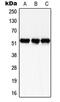 SMAD Family Member 3 antibody, MBS821830, MyBioSource, Western Blot image 