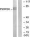 Ribosomal Protein S6 Kinase A1 antibody, TA326079, Origene, Western Blot image 