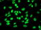 Retinol Binding Protein 1 antibody, M03820-1, Boster Biological Technology, Immunofluorescence image 
