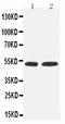 Myocyte Enhancer Factor 2C antibody, PA1824, Boster Biological Technology, Western Blot image 