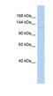 Dual serine/threonine and tyrosine protein kinase antibody, NBP1-54845, Novus Biologicals, Western Blot image 