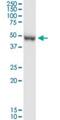 Protein Arginine Methyltransferase 8 antibody, H00056341-D01P, Novus Biologicals, Western Blot image 