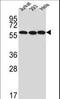 U3 small nucleolar RNA-associated protein 6 homolog antibody, LS-C160488, Lifespan Biosciences, Western Blot image 