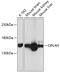 5-Oxoprolinase, ATP-Hydrolysing antibody, A11695, Boster Biological Technology, Western Blot image 