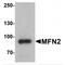 Mitofusin 2 antibody, TA349064, Origene, Western Blot image 