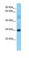 Armadillo Like Helical Domain Containing 3 antibody, orb325515, Biorbyt, Western Blot image 