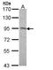 Desmocollin 2 antibody, LS-C186031, Lifespan Biosciences, Western Blot image 