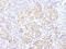 Proteasome Subunit Beta 5 antibody, A303-847A, Bethyl Labs, Immunohistochemistry paraffin image 