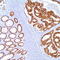 Caudal Type Homeobox 2 antibody, TA327657, Origene, Immunohistochemistry paraffin image 
