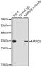 Mitochondrial Ribosomal Protein L28 antibody, GTX54321, GeneTex, Immunoprecipitation image 