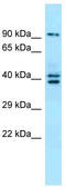L3MBTL Histone Methyl-Lysine Binding Protein 3 antibody, TA339772, Origene, Western Blot image 