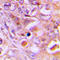 Ribosomal Protein L18 antibody, LS-C358288, Lifespan Biosciences, Immunohistochemistry paraffin image 