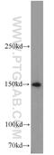 Sterile Alpha Motif Domain Containing 9 antibody, 22786-1-AP, Proteintech Group, Western Blot image 
