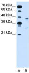 G Protein-Coupled Receptor 161 antibody, TA346459, Origene, Western Blot image 