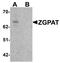 Zinc finger CCCH-type with G patch domain-containing protein antibody, PA5-72737, Invitrogen Antibodies, Western Blot image 