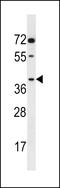 Aldo-Keto Reductase Family 1 Member E2 antibody, LS-C161029, Lifespan Biosciences, Western Blot image 