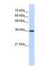 Aldo-Keto Reductase Family 7 Member A3 antibody, NBP1-56768, Novus Biologicals, Western Blot image 