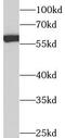 CAP-50 antibody, FNab00428, FineTest, Western Blot image 
