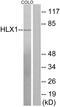 H2.0-like homeobox protein antibody, A30494, Boster Biological Technology, Western Blot image 