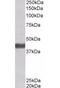 F-Box Protein 32 antibody, orb20141, Biorbyt, Western Blot image 