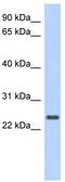Coiled-Coil Domain Containing 70 antibody, TA335436, Origene, Western Blot image 