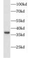 CXXC Finger Protein 5 antibody, FNab02113, FineTest, Western Blot image 