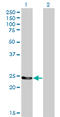 Glutathione S-transferase Mu 4 antibody, LS-C197368, Lifespan Biosciences, Western Blot image 