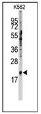 Small Nuclear Ribonucleoprotein Polypeptide C antibody, AP12499PU-N, Origene, Western Blot image 