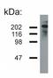 NEFH antibody, AM26036PU-N, Origene, Western Blot image 