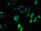 CD11A antibody, CSB-PA05204A0Rb, Cusabio, Immunofluorescence image 