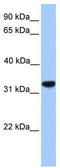 Calcium Voltage-Gated Channel Auxiliary Subunit Gamma 4 antibody, TA338573, Origene, Western Blot image 