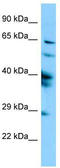 Sperm-associated antigen 16 protein antibody, TA331230, Origene, Western Blot image 