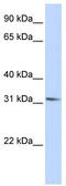 Rhox Homeobox Family Member 2 antibody, TA331692, Origene, Western Blot image 