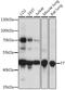 F7 antibody, A00693, Boster Biological Technology, Western Blot image 