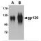 Retrovirus-related Env polyprotein from Fv-4 locus antibody, TA160085, Origene, Western Blot image 