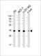 Pyridoxal kinase antibody, M06683, Boster Biological Technology, Western Blot image 