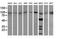 Phosphoinositide-3-Kinase Regulatory Subunit 5 antibody, NBP2-46413, Novus Biologicals, Western Blot image 