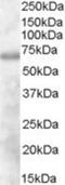 Differentially expressed in FDCP 6 antibody, NB300-837, Novus Biologicals, Western Blot image 