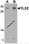 T Cell Leukemia Homeobox 2 antibody, 7373, ProSci, Western Blot image 