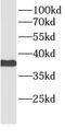 BMI1 Proto-Oncogene, Polycomb Ring Finger antibody, FNab00914, FineTest, Western Blot image 