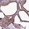 Round Spermatid Basic Protein 1 antibody, PA5-59879, Invitrogen Antibodies, Immunohistochemistry frozen image 