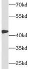 Complement Factor H Related 3 antibody, FNab09927, FineTest, Western Blot image 