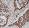HCK Proto-Oncogene, Src Family Tyrosine Kinase antibody, FNab03785, FineTest, Immunohistochemistry frozen image 