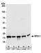Ribosomal Protein S11 antibody, A303-936A, Bethyl Labs, Western Blot image 