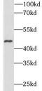 Transcription Factor AP-2 Alpha antibody, FNab09980, FineTest, Western Blot image 