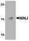 Ninjurin 1 antibody, A08377, Boster Biological Technology, Western Blot image 